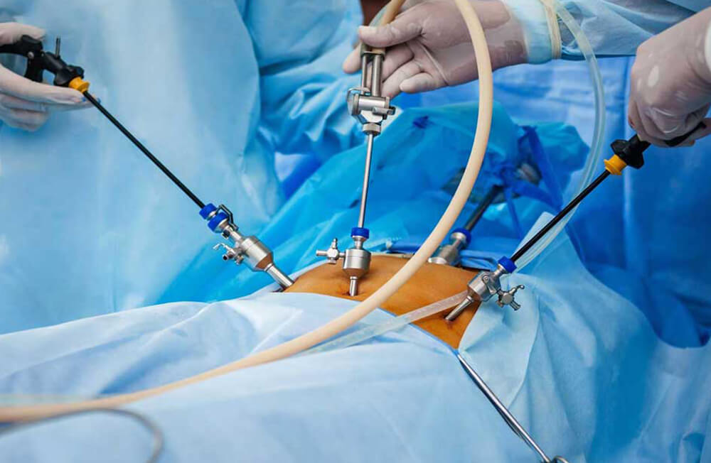 laparoskopiki xeirourgiki